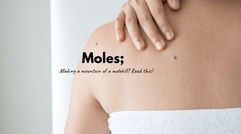 Moles