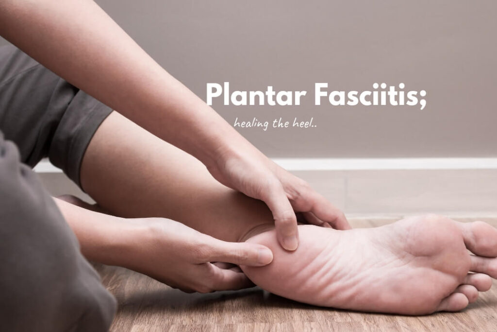 Plantar Fasciitis