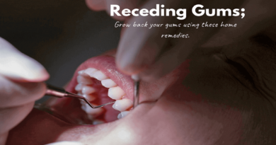 Receding Gums