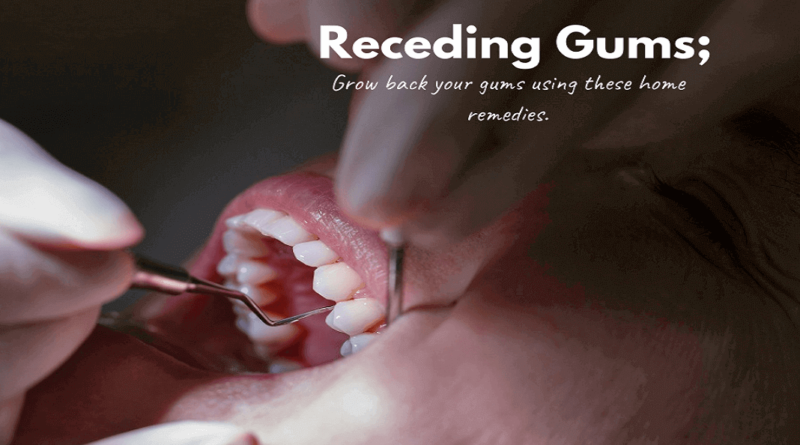 Receding Gums