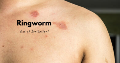 Ringworm