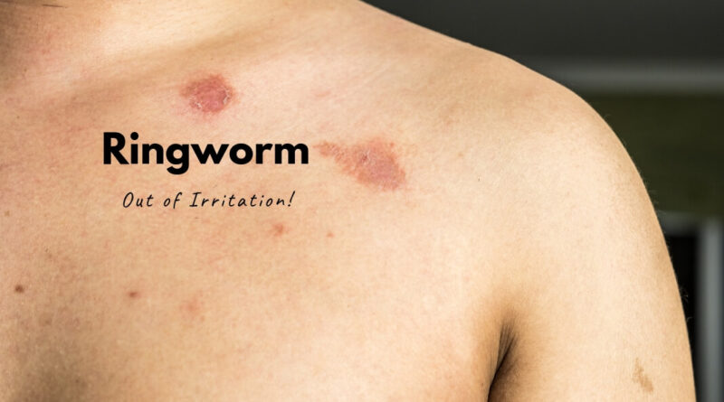 Ringworm