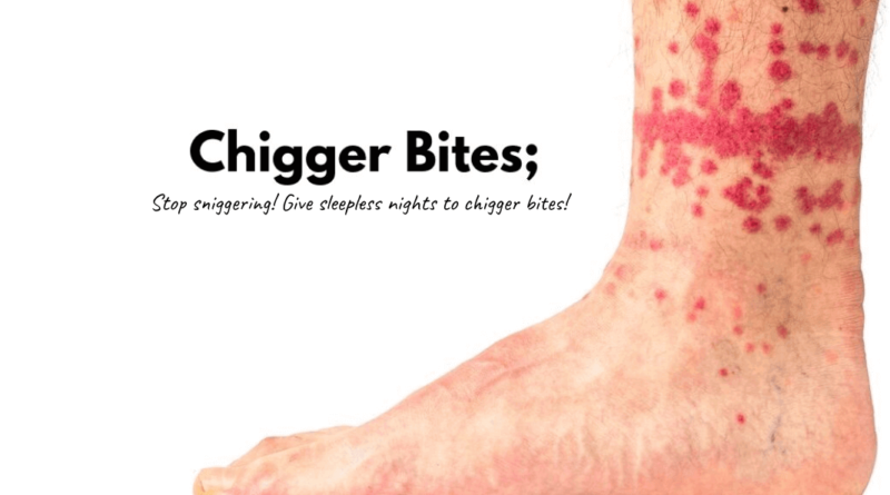 chigger bites