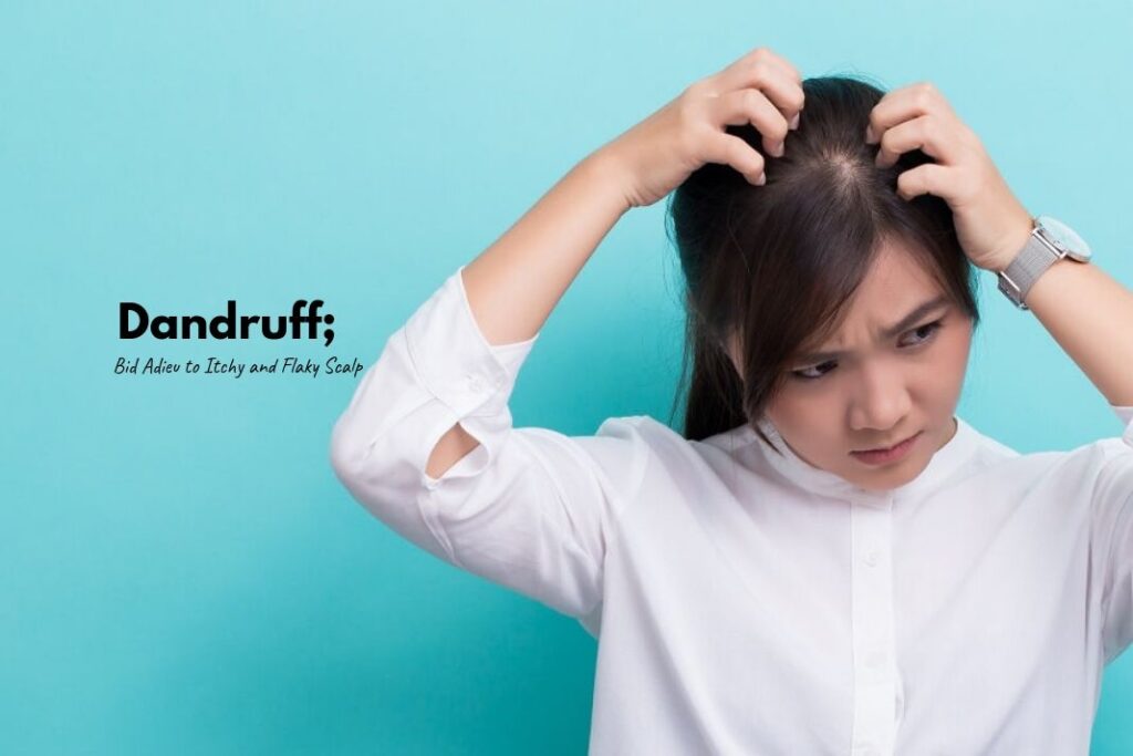 how to get rid of dandruff