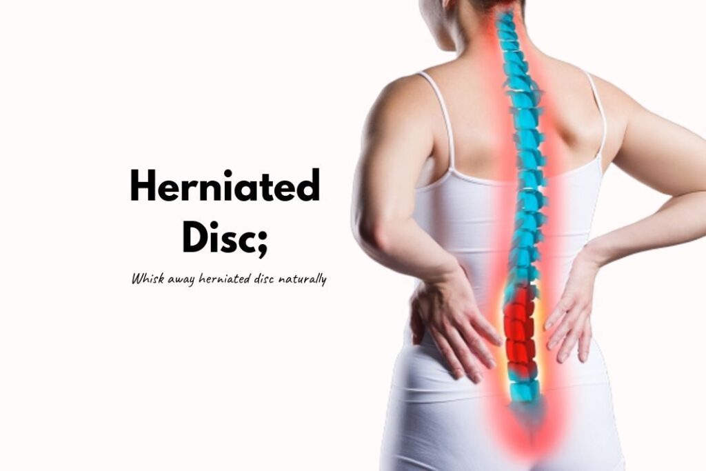 how to heal a herniated disc naturally