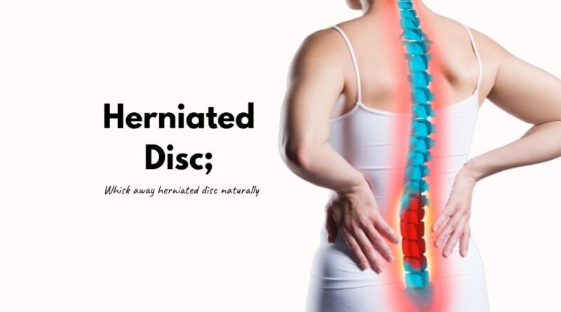 how to heal a herniated disc naturally