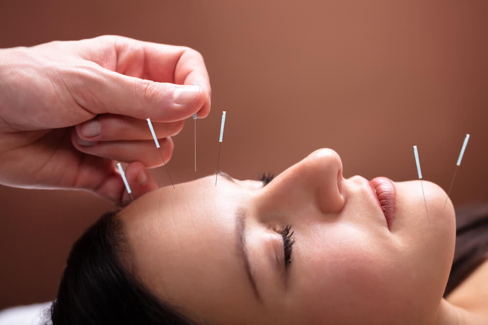 Acupuncture Treatment for Allergies