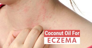 Coconut Oil for Eczema