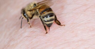 Home Remedies For Bee Stings