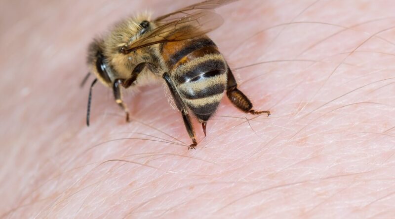 Home Remedies For Bee Stings
