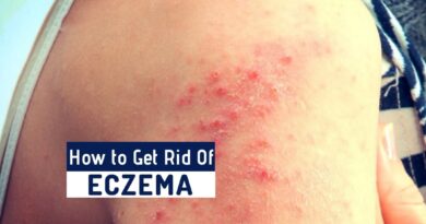 How to Get Rid of Eczema