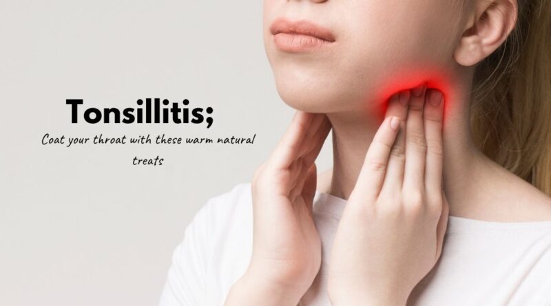 How to Treat Tonsillitis