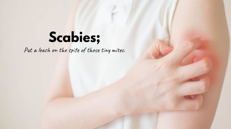 Scabies