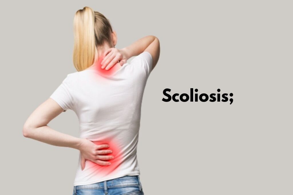 Scoliosis