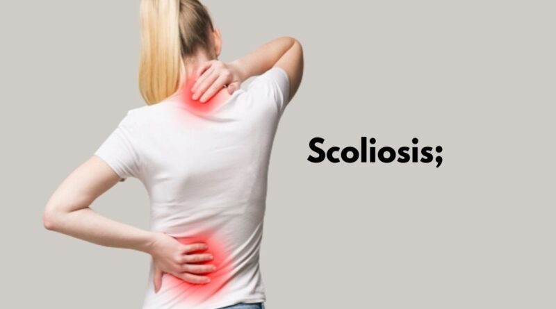 Scoliosis