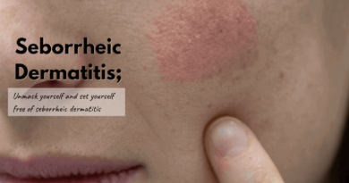 Seborrheic Dermatitis