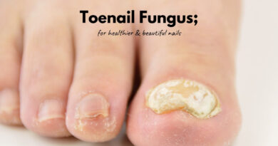 Toenail Fungus