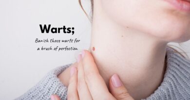 Warts