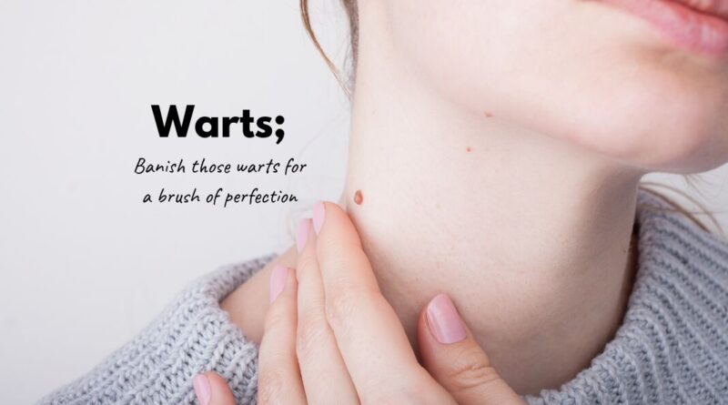 Warts