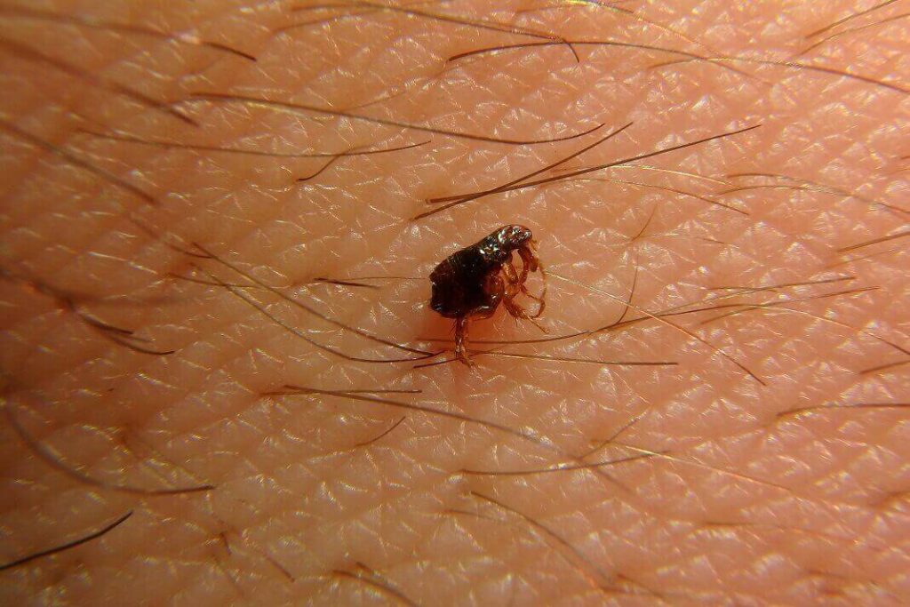 home remedies for flea bites