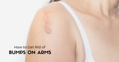 how to get rid of bumps on arms