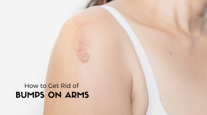 how to get rid of bumps on arms